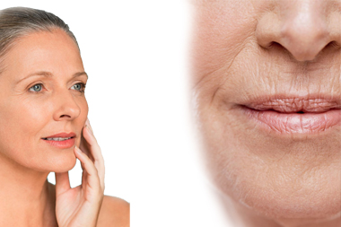 Anti Aging Mesotherapie